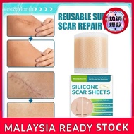 Silicone scar tape silicone scar patch keloid removal scar silicone sheet scar patch 4cm*150cm