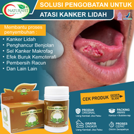 Obat Kanker Lidah Paling Ampuh Tumor Lidah Kandidiasis Kangker Kelenjar Air Ludah Benjolan Kanker Di