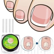 50Pcs Professional Ingrown Toenail Correction Tool / Ingrown Toenail Corrector Pad/Paronychia Correc