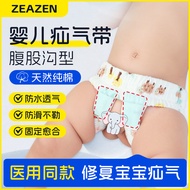 Infant Hernia Fixation Belt for Boys and Girls, Groin Type Special Hernia Treatment Rehabilitation C