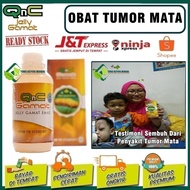 Eye Tumor Medicine, There Is A Benjolan In Eyes, Safe For Children &amp; Adults | Qnc Jelly Gamat 100% Original