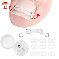 Amonghot> 1/2 Set Ingrown Toenail Corrector Tools Pedicure Recover Embed Toenail Treatment Foot Care