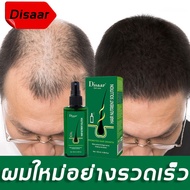 【ของแท้100%】Disaar สเปรย์ปลูกผม นีโอแฮร์ของแท้ เซรั่มปลูกผม น้ำยาปลูกผม120ml บอกลาหัวล้าน ป้องกันผมร