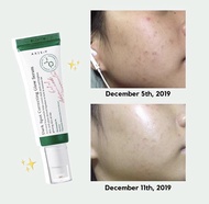 Tinh Chất Giảm Thâm Mụn AXIS -Y Dark Spot Correcting Glow Serum