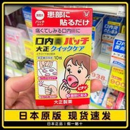 （下單發電話才能出貨）日本大正口腔貼紙口內炎貼口腔膏口腔炎10片加強版加速愈合