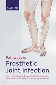 Pathways in Prosthetic Joint Infection Umraz Khan