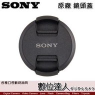 【數位達人】SONY 77mm 原廠鏡頭蓋 ALC-F77S / 保護蓋 原廠鏡頭前蓋 LENS CAP