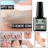 EELHOE NAIL FUNGUS TREATMENT Rawat kulat kuku baiki kuku nail repair nail treatment hapus kulat kuku