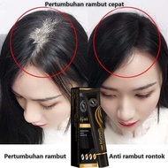 Obat penumbuh rambut Penumbuh rambut botak Serum penumbuh rambut Hair