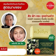 สบู่สมุนไพร สูตรนางแซง ลดปัญหา ฝ้า กระ จุดด่างดำ