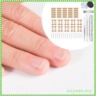 [IniyexaMY] Ingrown Toenail Correction Kit Elastic Ingrown Toenail Correction Patch