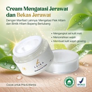 EFFECTIVE Acne Scar Cream Acne Scar Remover acne remover acne medication acne ointment acne spot tre