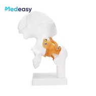 Human Anatomy Hip Joint Model
