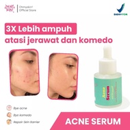 Mfi - Oh My Skin! Acne Serum | Net 20ml | Acne Serum By Oh My Skin!