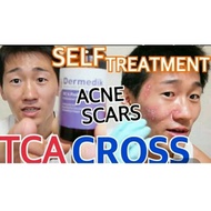 Tca 15%-tca 100%( trial size ) tca cross original/boxscar,ice pick scar.