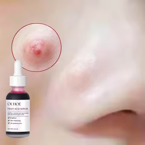 Salicylic Acid Care Essence Deep Hydration Gentle Nourishment Soothes Redness Smooths & Refines Firm