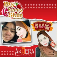 MY CHERRY SKIN ADVANCED 4 BOX WHITENING SUPPLEMENT [KESAN SEAWAL 7 HARI]