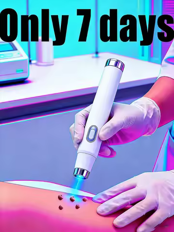 Latest Blue Laser Pen,The latest one makes your skin smooth and flawless.