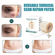 Silicone Scar Sheets Roll 5*150cm Medical Scar Tape Reusable For Surgical C-Section Scar Repair