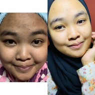 Skincare Jeragat/Jerawat Organik MK Beauty