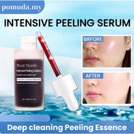 Intensive Peeling Solution 30ML Peeling solution Whitening Smooth pores Deep cleaning Peeling Essenc