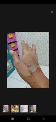 SALE TCA GEL TCA 25 peeling cream home peeling pemutih kulit badan wajah terbatas