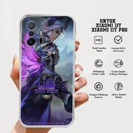 Case XIAOMI 11T/11T PRO - Latest XIAOMI 11T Case Diamons Case [MOTIF 24] Casing Hp XIAOMI 11T/11T PRO - Casing Hp - Softcase Hp XIAOMI 11T PRO - Hardcase Hp - Luxury Case - Case - Latest Case -