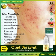 PROPOLIS SM Obat Totol Jerawat Pria dan Wanita 100% Atasi Obat Jerawat Batu Jerawat Bernanah Jerawat