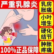 Hard Lump Hyperplasia Multiple External Use Cream Hyperplasia Menstrual Pain Cyst Small Leaf Breast 