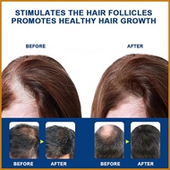 Hair Growth Essence 20g Anti Alopecia Fast Hair Growth Oil Anti Alopecia Fast Hair Growth Oil Liquorice Regrowth kiodmy