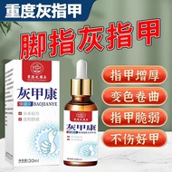 纯淳香港大药房灰甲康抑手机支架新亮甲水 脱甲 1瓶