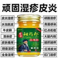 Miaojia Eczema Cream Stubborn Eczema Piyan Eczema Red Eczema Eczema Eczema Eczema Blister Skin Itchi