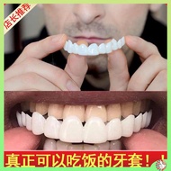 gigi palsu silikon gigi palsu Artifak makan pendakap gigi Orang tua dengan gigi yang hilang di antara gigi