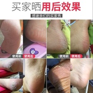 Portable Electric Foot Grinder Skin Remover Rechargeable Pedicure Foot Care Tool / Automatic Foot Gr