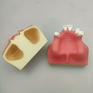 IMPLANT PLUG | IMPLANT ACTUAL MODEL HAM