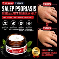 Psoriasis Cream  Eczema cream Antifungal cream Cream gatal kulit 30g krim gatal kulit herba cina Uba