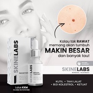 [100% ORIGINAL HQ | READY STOCK] SKINELABS REMOVAL TREATMENT - HILANGKAN KETUAT, BIJI KOLESTROL, TAH