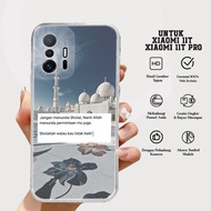 Case XIAOMI 11T/11T PRO - Latest XIAOMI 11T Case Diamons Case [MOTIF 29] Casing Hp XIAOMI 11T/11T PRO - Casing Hp - Softcase Hp XIAOMI 11T PRO - Hardcase Hp - Luxury Case - Case - Latest Case -