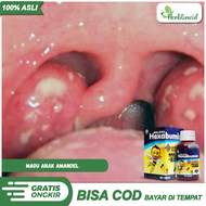 Madu Sirup Syrup Buat Amndel Anak Kecil/Obat Radang Tenggorokan Amandel Balita Usia 1 2 3 4 5 Tahun/