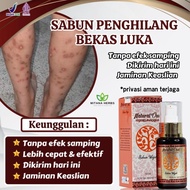 KesejahteraanKesejahteraanSabun Koreng Di Kaki - sabun penghilang bekas luka Hitam Koreng - Penghila