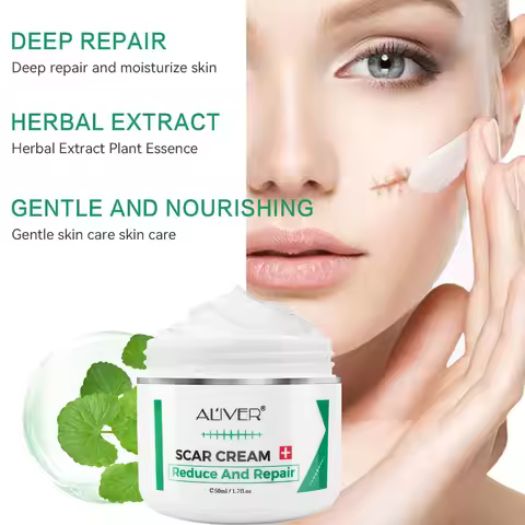 ALVER Acne Scar Stretch Marks Remover Cream Skin Repair Acne Black Dots Spots Acne Treatment Blackhe