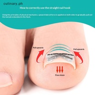 2pcs Ingrown Toenail Corrector Pedicure Recover Embed Toe Nail Treatment Professional Ingrown Toenai