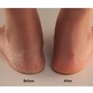 【Oseque】脚部去角质套装🦶🏻 Silk Foot Deep Care Set