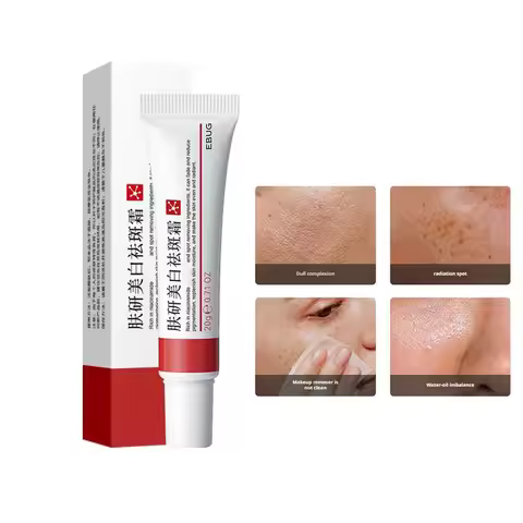 Powerful Whiten Freckle Cream Brighten Face Eliminates Dark Face Spot Melasma Melanin Pigmentation M