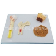 Harvard Human Body Cartilage Bone Bone Membrane Model Bone Loose Teaching Model Structure Bone Secre