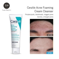 Cerave mụn tạo bọt kem sữa rửa mặt với 4% benaoyl Peroxide Hydrating Sữa rửa mặt với Hyaluronic axít