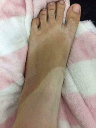 ( 1 tặng 1) Lột thay da sinh học NN + tặng kem dưỡng trắng sau lột