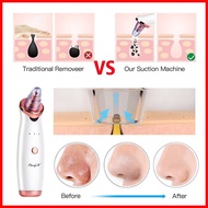 ✙ ✨ ❃ Ckeyin Vacuum Blackhead Remover Electric Pore Suction Facial Clean MR278