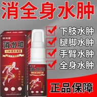 Old Brand Edema Reduce Swelling Pain Removal Spray Sedentary Sitting Legs Foot Edema Spray Senior Pe