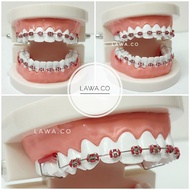 BRACES CLICK FASHION BY LAWA.CO [READY STOCK] PENDAKAP GIGI BEHEL GIGI VIRAL FAST SHIPPING